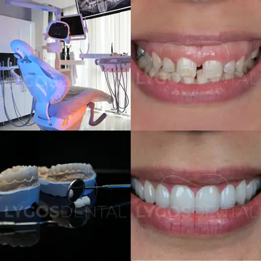 best dental clinics in Turkey